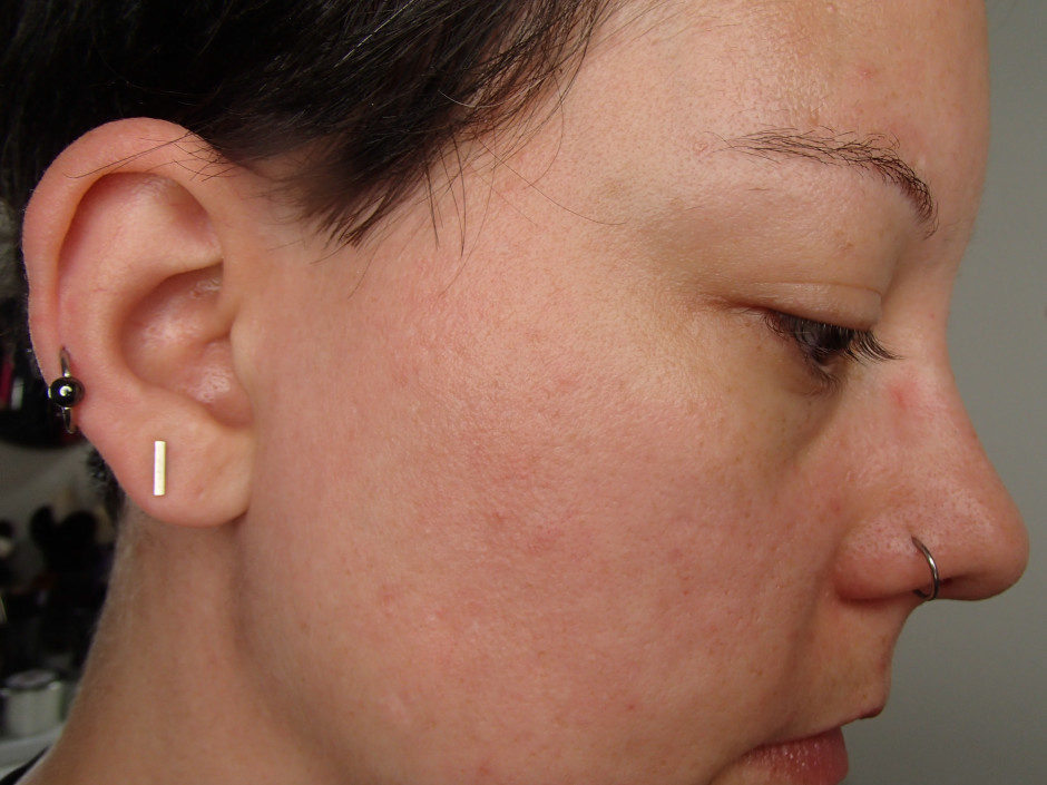 ORG MIneral Peel - before