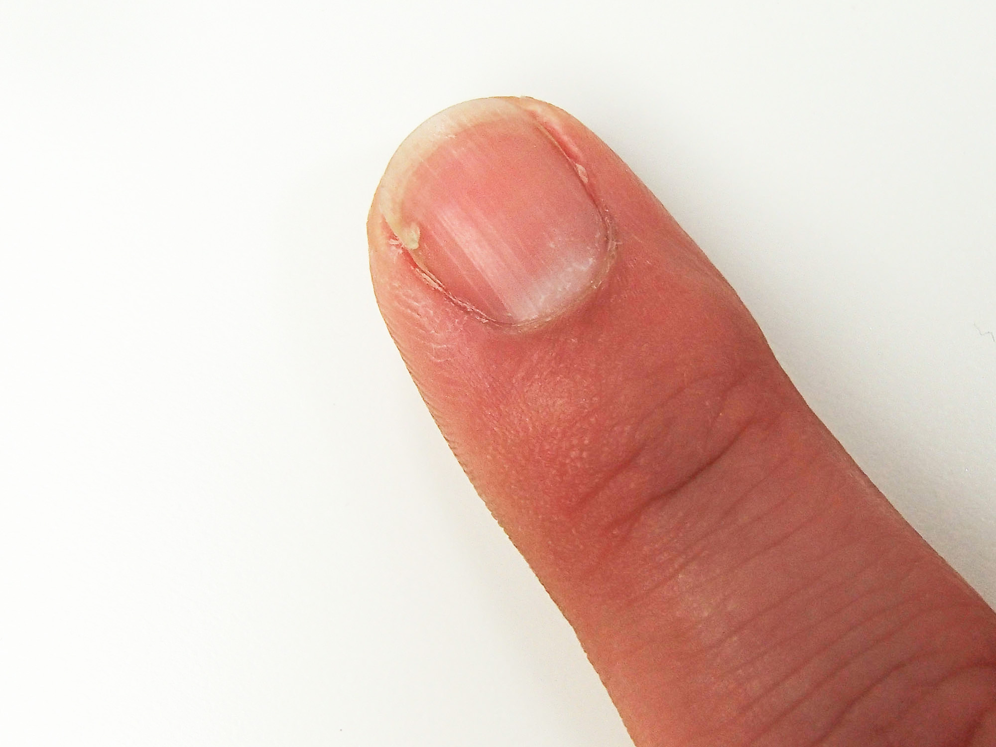 Quick & easy way to bandage a cracked nail – Lipstick Latitude