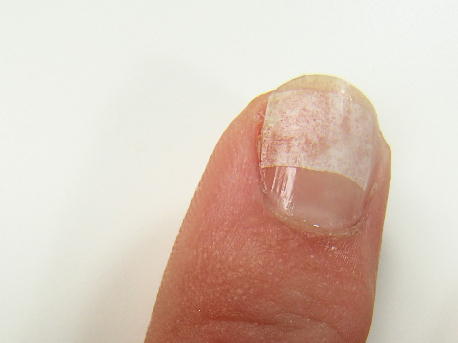 Tutorial - Bandage a cracked nail