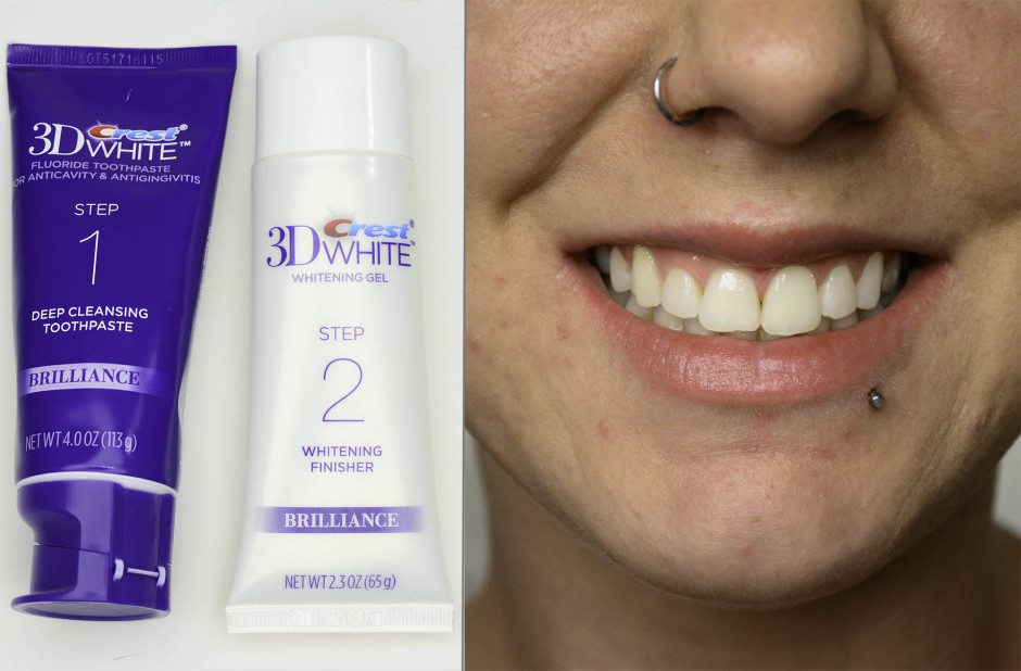 3 Quick Ways to Hide the Signs of Aging: Brighten Your Smile